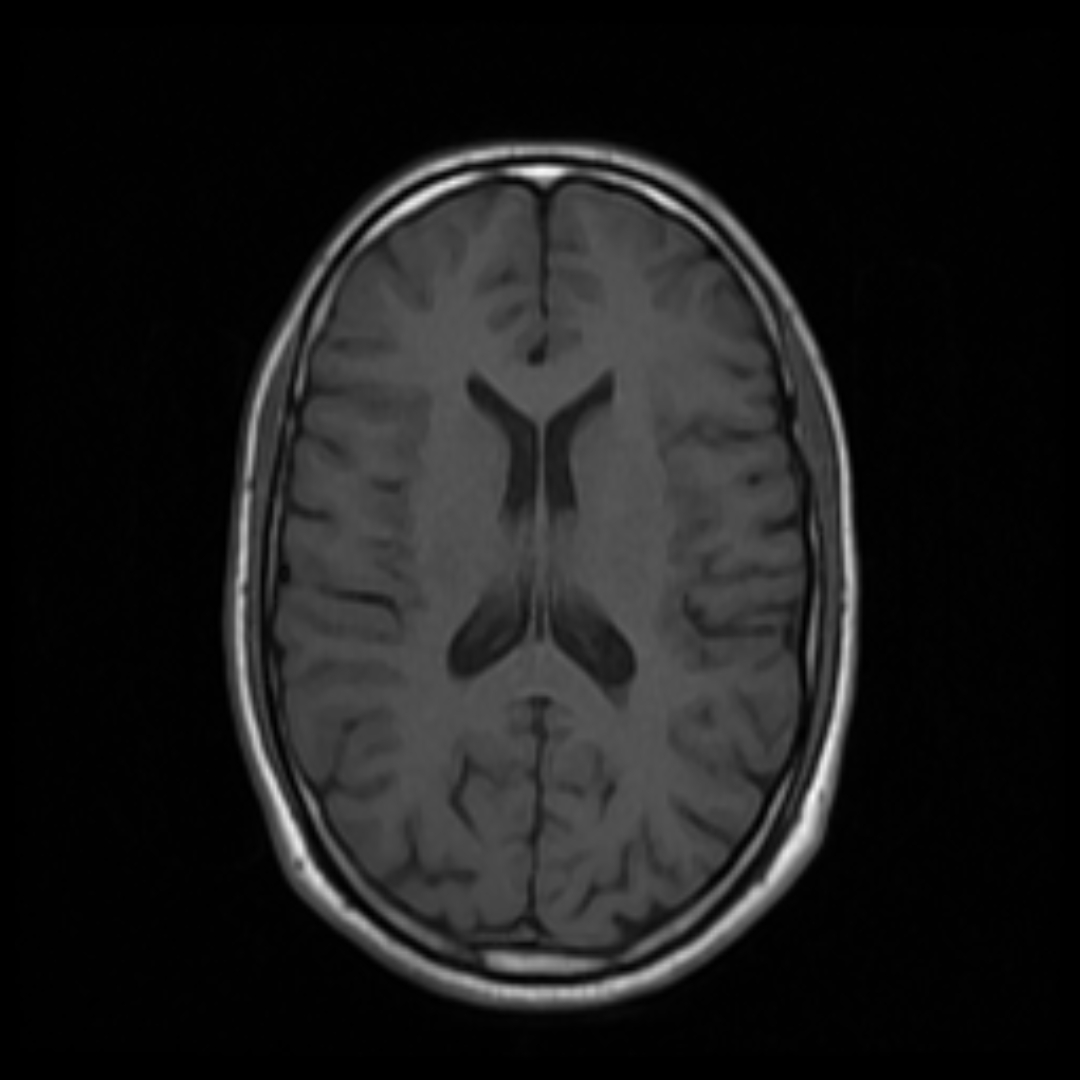 Axial T1-weighted MRI with tissue callouts